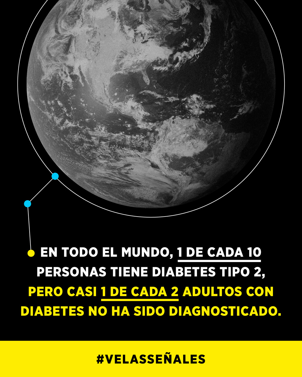 Globally, 1 in 10 people have type 2 diabetes but almost 1 in 2 adults with diabetes are undiagnosed
